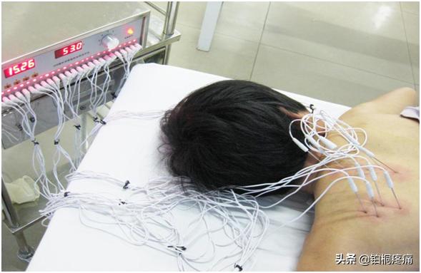 肩周炎胳膊疼的抬不起来怎么治疗,肩周炎手臂粘连抬不起来治疗方法