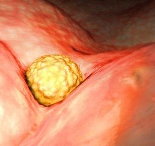 3d演示胎儿发育全过程,胚胎发育全过程3d演示