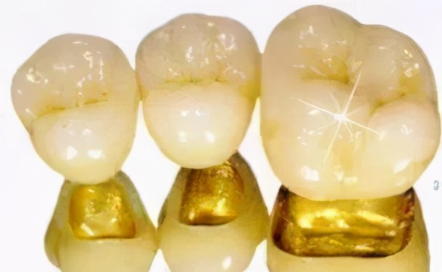 上海雅悦齿科种植牙,雅悦齿科种植牙