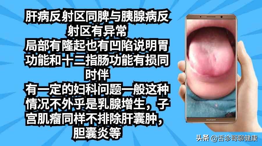 胰腺炎看舌苔判断,舌诊歌舌象分析与感悟