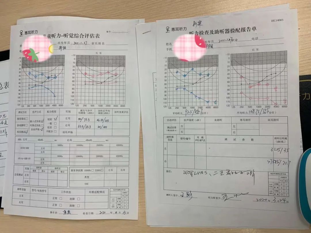 大前庭治疗的最新科技,大前庭什么时候能治