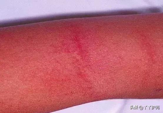 儿科常见出疹性疾病,儿科常见出疹性疾病有哪些