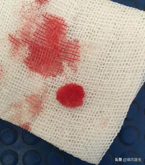 猫在被子里憋死,猫在体内就憋死了