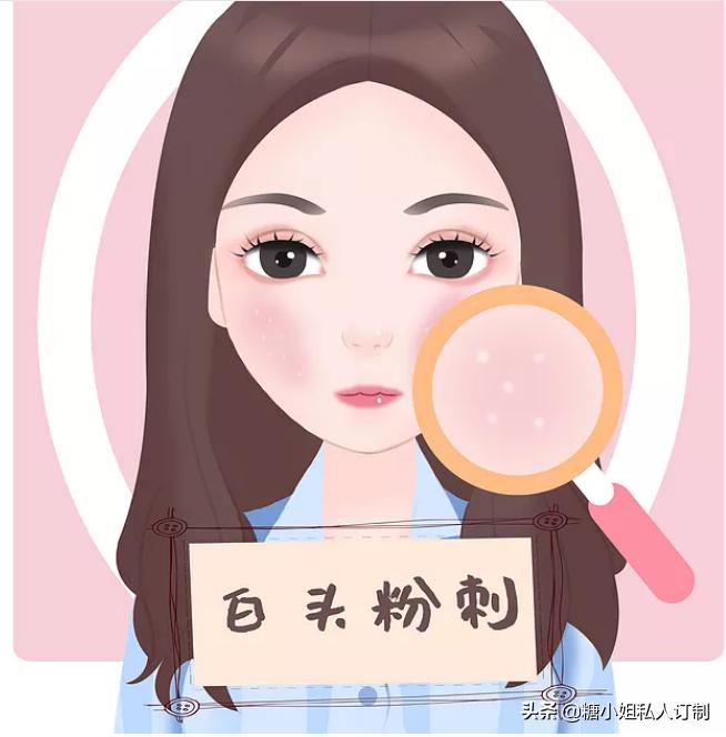 痘痘跟黑痣一样怎么去除,痘痘里面的白色硬颗粒怎么消除