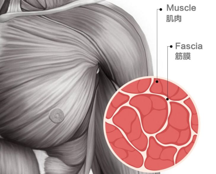 久了不运动突然运动浑身酸痛,为什么运动之后全身很痛