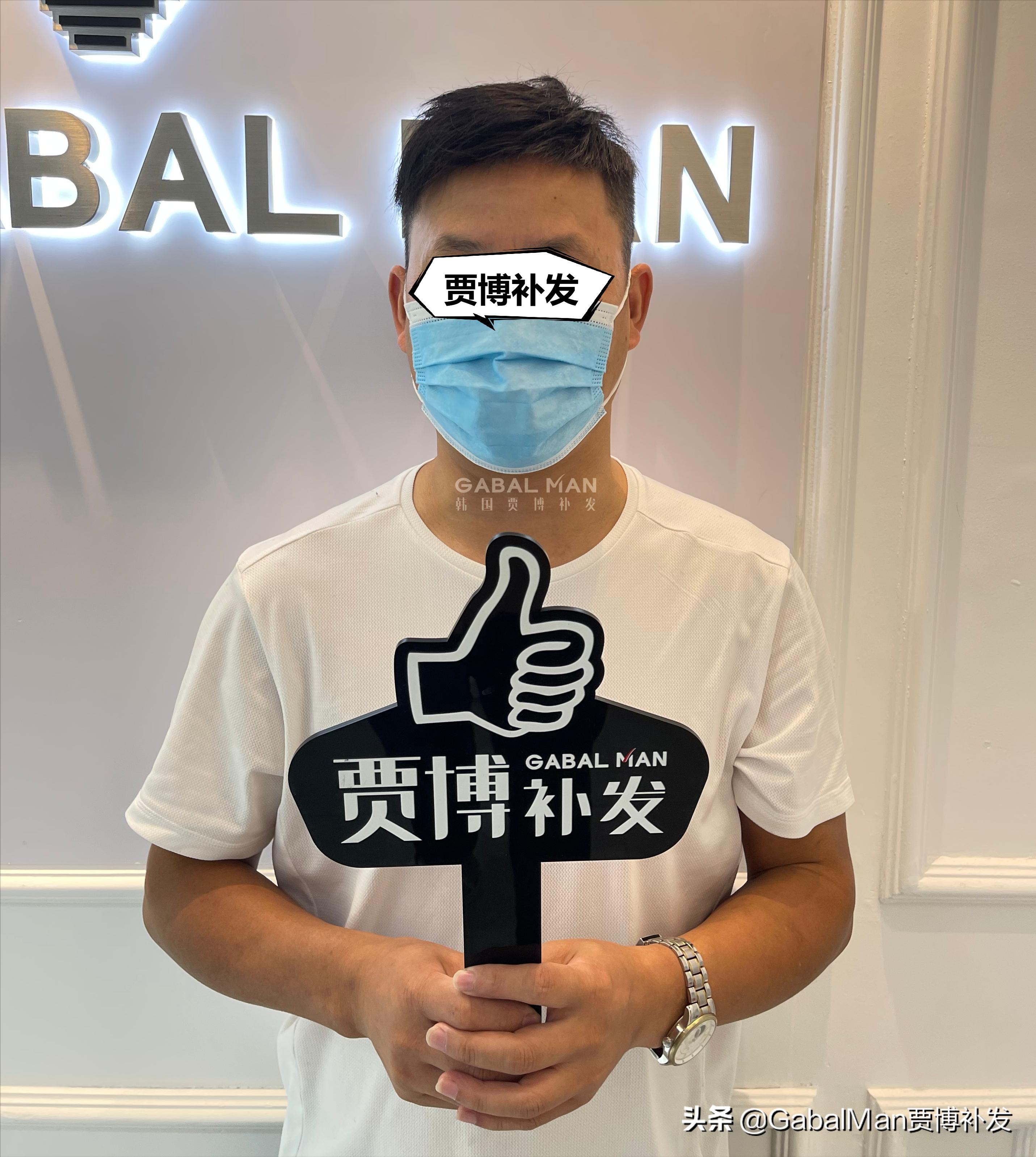 头顶脱发戴什么样的假发好,头顶脱发没有刘海用什么样的假发