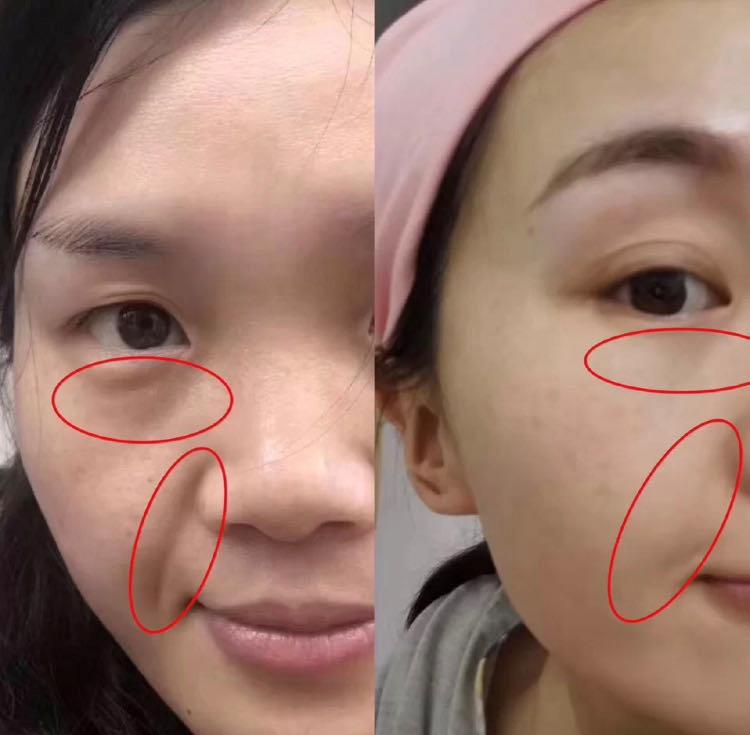 20岁少女一夜变成老太婆,妙龄少女一夜间变成老太太后续