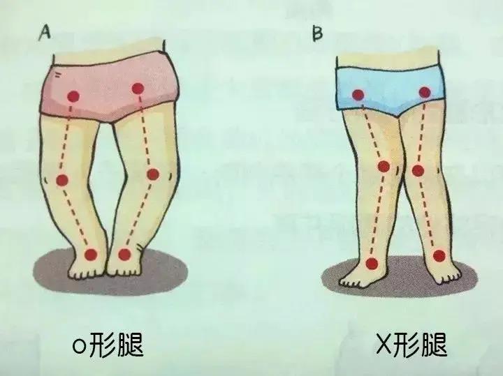 求求宝妈们别再这样给宝宝穿纸尿裤了!这些你都中招了吗?