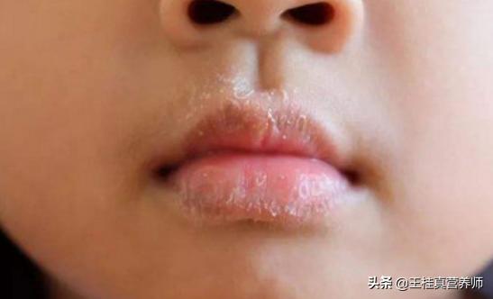 宝宝脸上一般会出现什么,孩子脸上4种特征