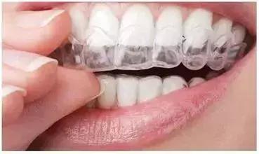 牙齿矫正疼痛有多厉害,牙齿矫正疼得厉害怎么回事