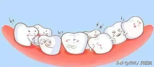 牙箍什么时候戴合适,14岁戴牙箍要戴多久