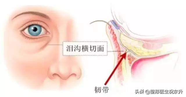 有眼袋泪沟化妆画卧蚕好看吗,泪沟跟卧蚕跟眼袋怎么区分