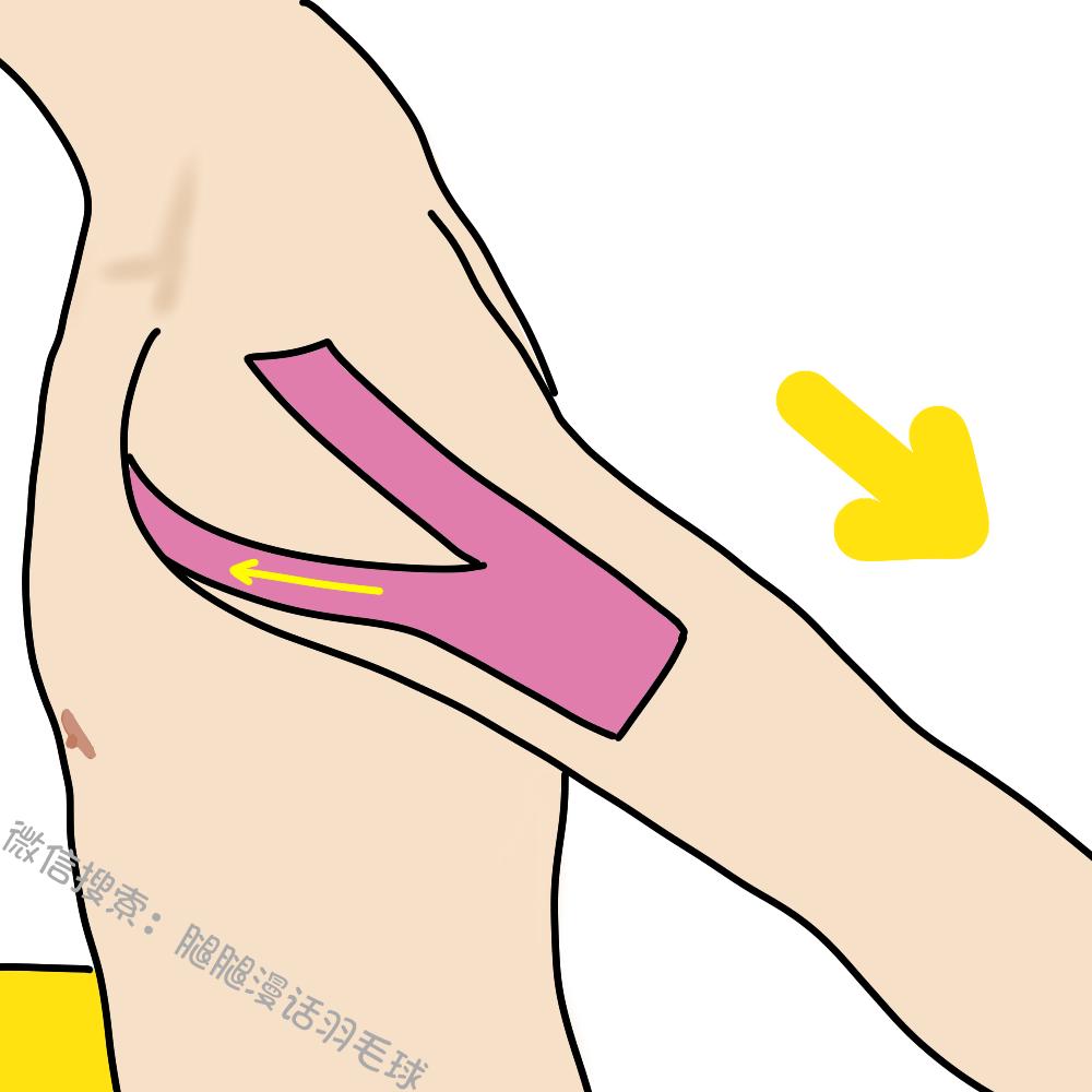 打球后肩膀痛怎么缓解,打球肩膀疼一招搞定