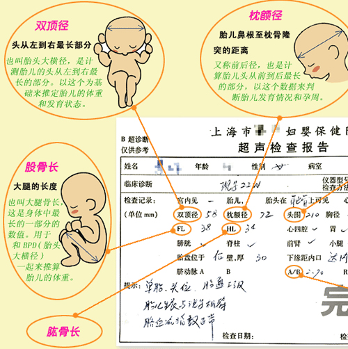 教你看懂b超报告,今年快递爆仓了
