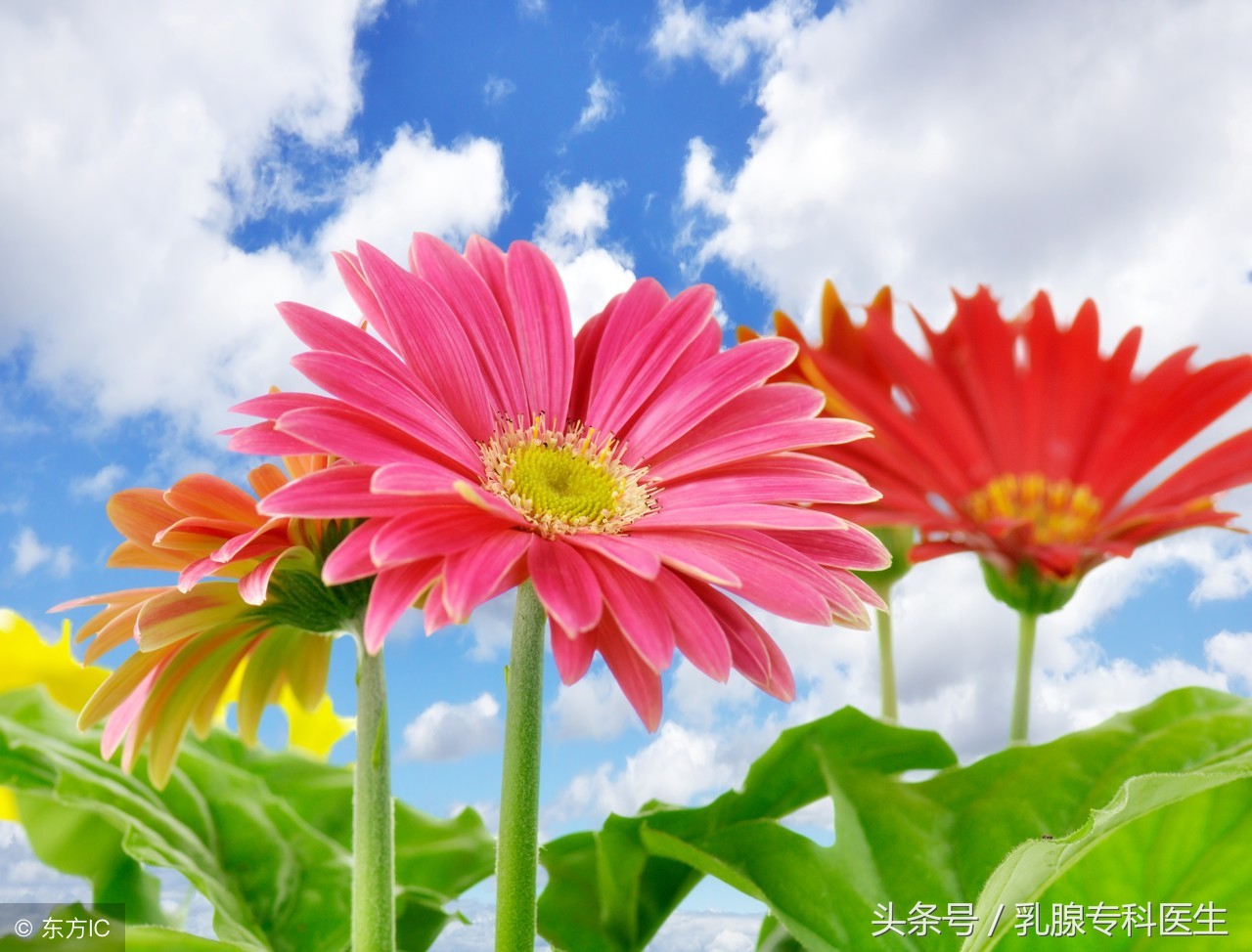 双侧乳腺增生症严重吗,得了乳腺增生该怎么办