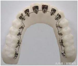 从3分到10分中间需要几分钟,从3分到4分付出了多大努力