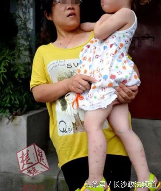 最近在家或外出都要小心它！一周内已有多人中招进了医院