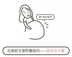 最好的预防妊娠纹的油,妊娠纹长后还能抹油消除吗