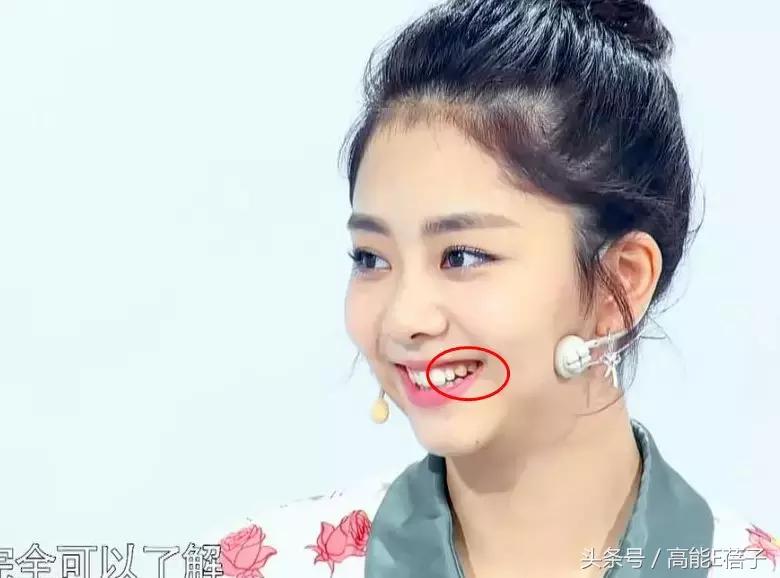 高圆圆牙齿美白,高圆圆40岁美白秘诀