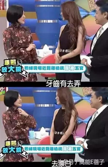 高圆圆牙齿美白,高圆圆40岁美白秘诀