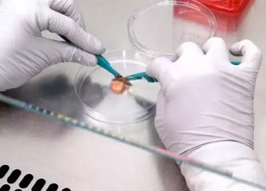 [抗癌突破]--惊人报道|每天小剂量伟哥可能减少结直肠癌风险！