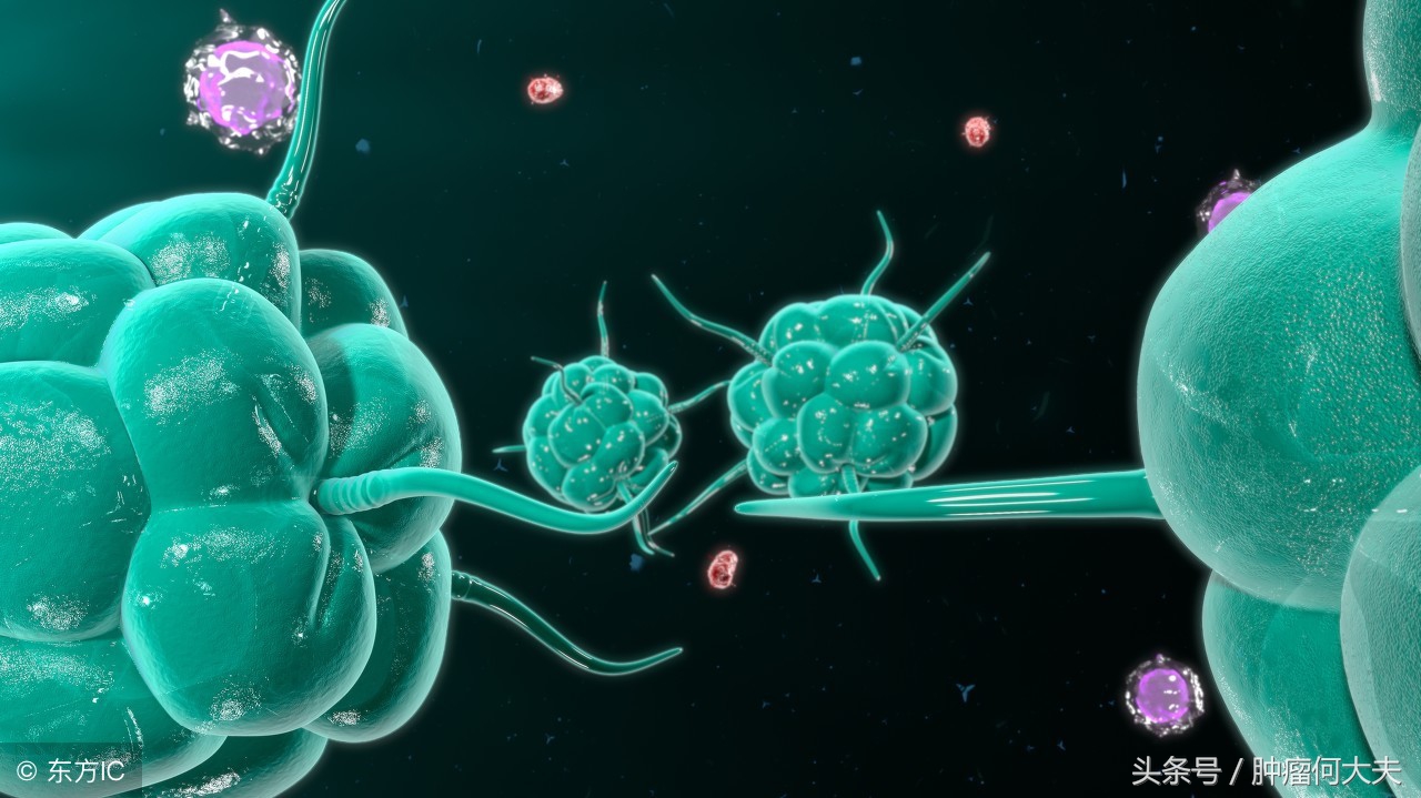 根除幽门螺杆菌是胃癌的一级预防,胃癌手术后还有幽门螺杆菌怎么办