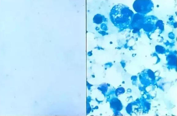 显微镜下母乳是这样的,这才是真相