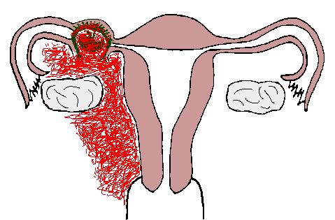 见红五天了还没动静什么原因,孕前期轻微见红是什么原因