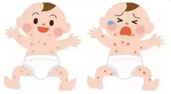 春季湿疹宝宝护理注意事项,冬季宝宝干性湿疹怎么办