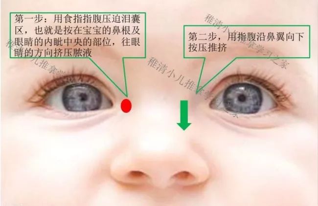 小孩上火了怎样降火最快小儿推拿,儿童上火口腔溃疡吃什么降火最快