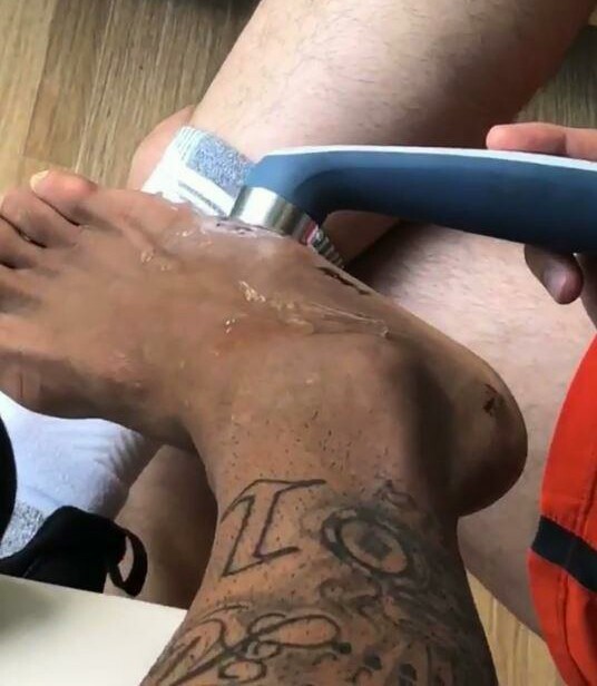 内马尔受伤后重回赛场了吗,内马尔受伤康复视频