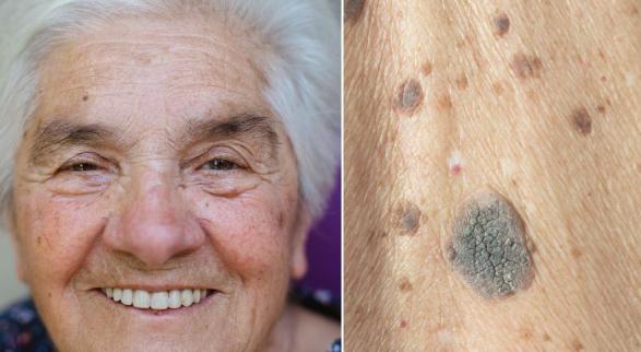 脸上莫名的小颗粒到底是什么？皮肤专家教你护肤