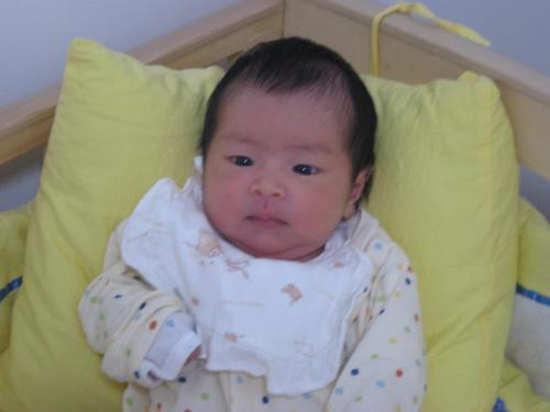 小儿黄疸引起的脑损伤,小孩黄疸引起睡觉一惊一乍怎么治