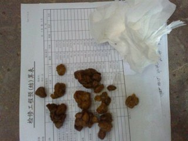 根据宝宝便便形状判断便秘,如何根据便便判断宝宝是否拉肚子