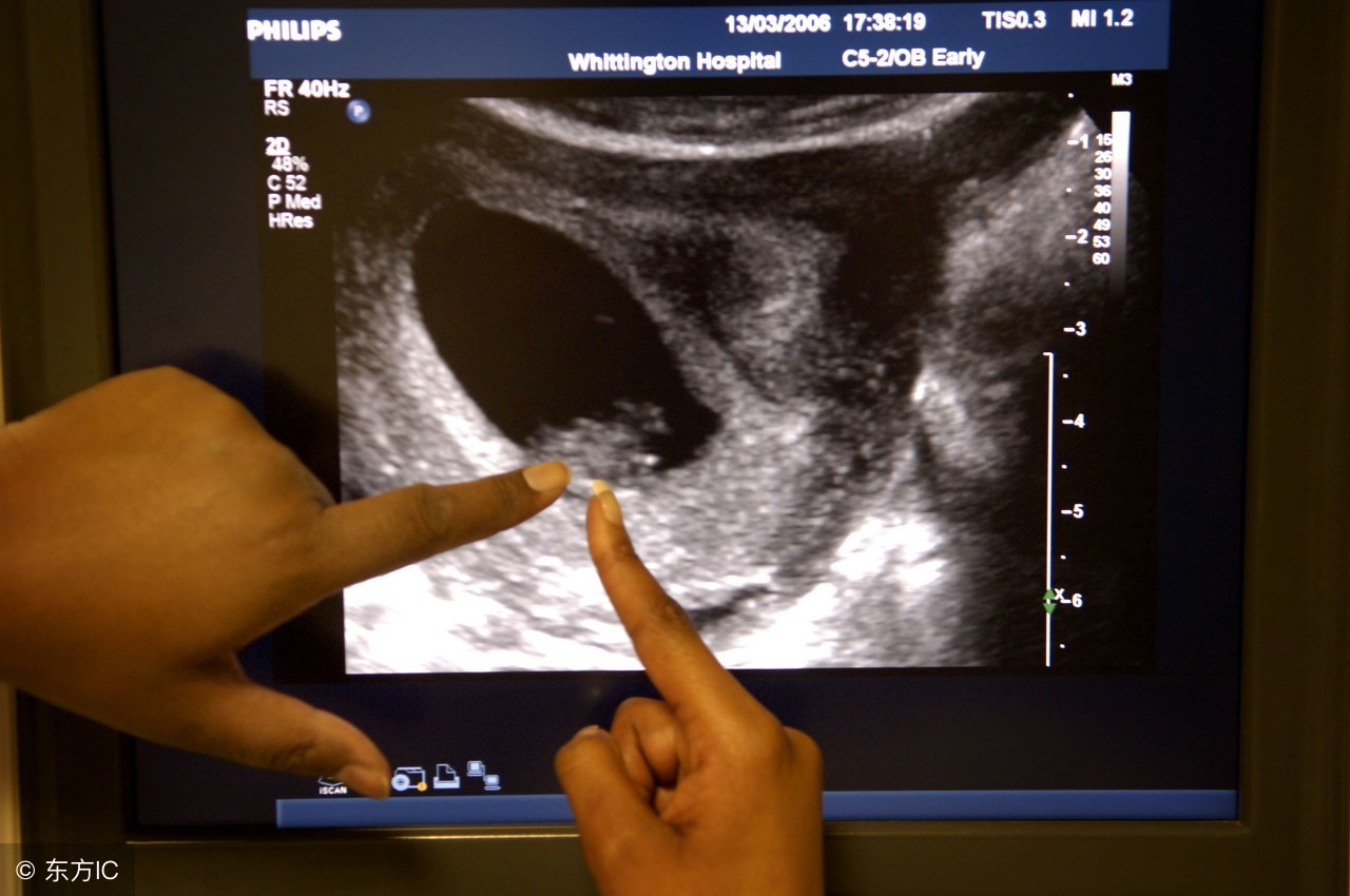 孕期见红是一直有吗,孕妇见红要流产吗