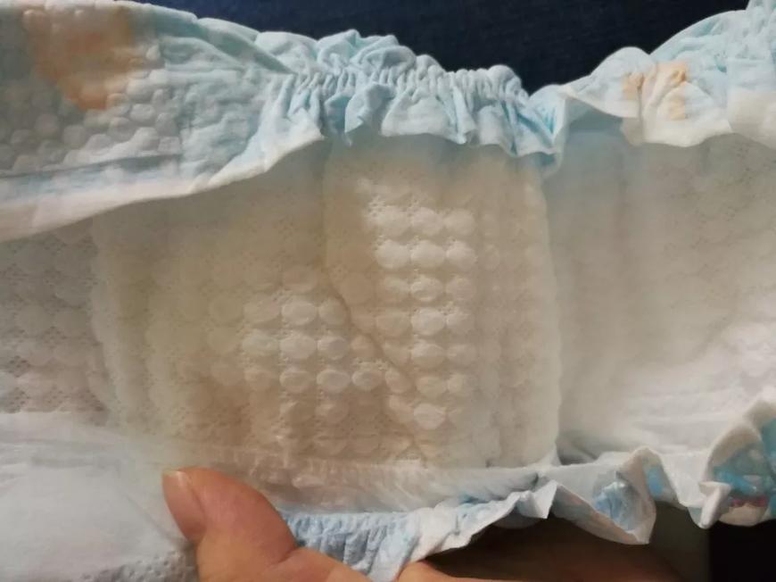 宝宝红屁屁和屁股湿疹区别,宝宝起湿疹跟纸尿裤有关系么