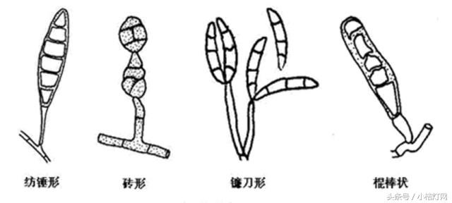 ivd基础知识大全,真菌检测要点