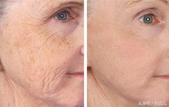 为什么范冰冰比林允气质好,范冰冰王菲谁漂亮