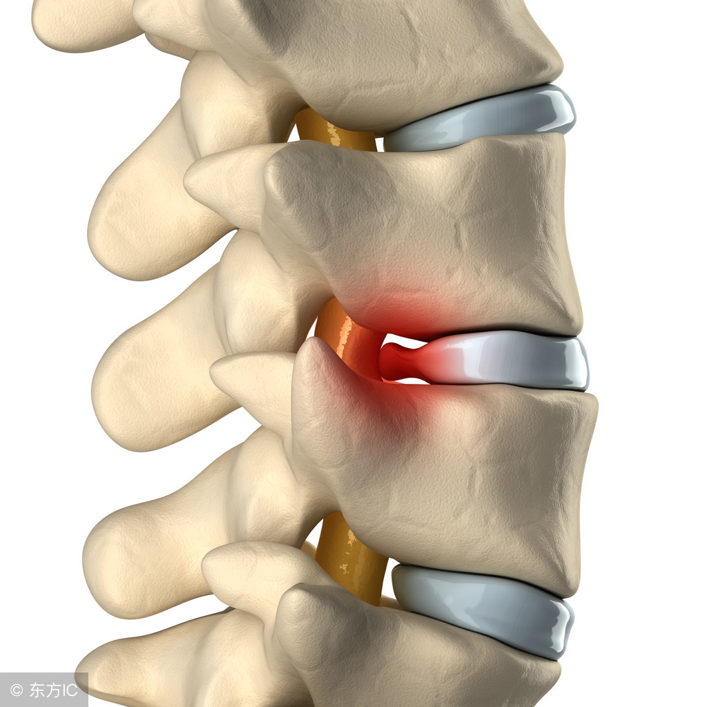 腰椎间盘突出腿痛按摩哪些穴位,腰椎间盘突出压迫神经屁股疼腿痛