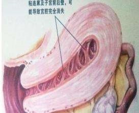 月经量变少是什么原因怎么办,月经量变得很少怎么回事