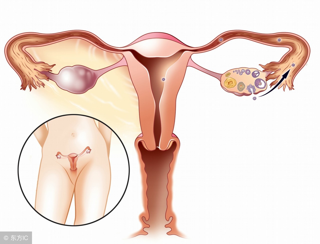 宫颈息肉是因为什么原因生长的,宫颈为什么会有息肉