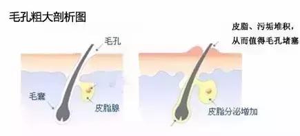 收缩毛孔的最好方法最简单的,脸部保养方法收缩毛孔