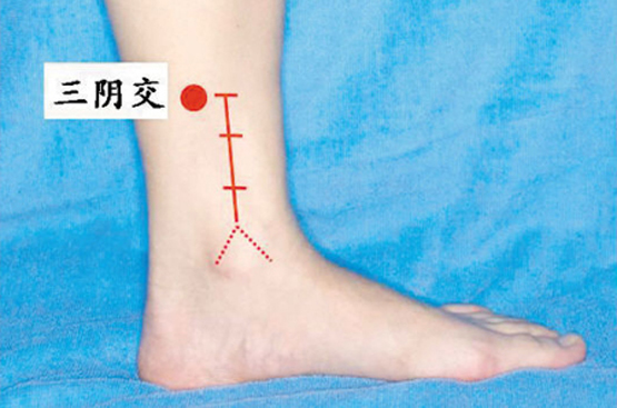 艾灸治阳痿穴位图,艾灸治阳痿案例