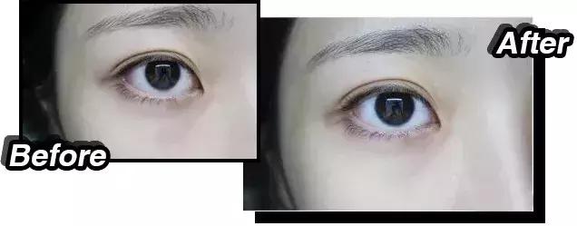 有什么平价且可以去黑眼圈的眼膜 (推荐去黑眼圈的眼膜)