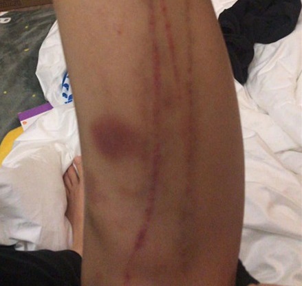 傅园慧奥运铜牌,傅园慧被教练骂视频