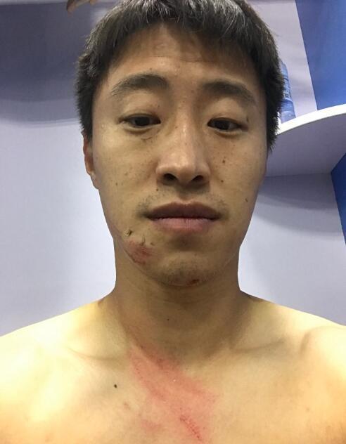 足球守门被爆头,足球守门员被爆头