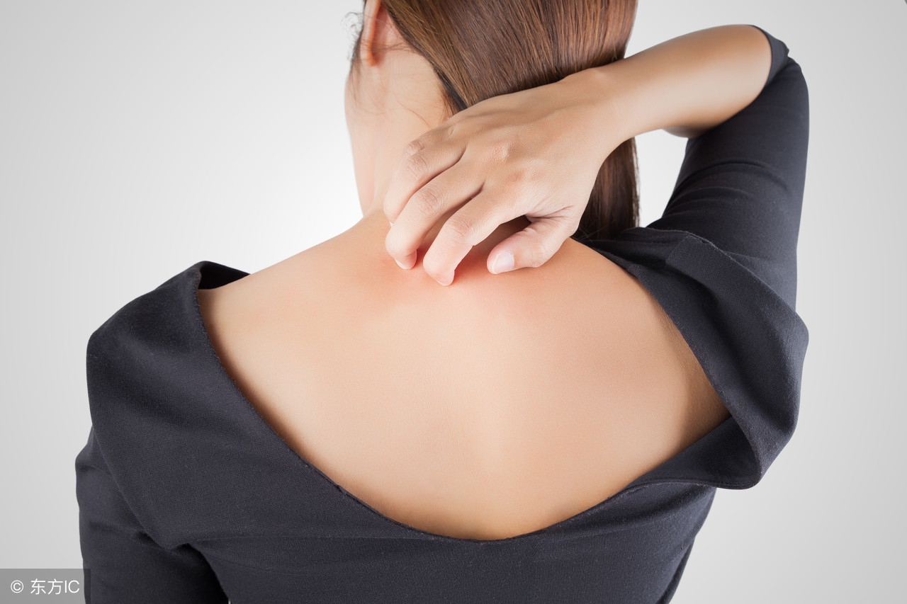 治痱子的秘籍大全,治疗痱子最快速有效的方法