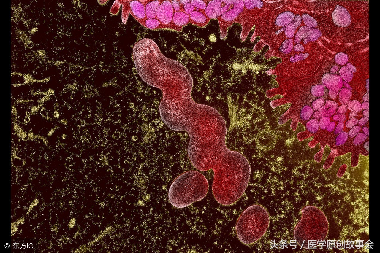 幽门螺杆菌最怕七种药,幽门螺杆菌最怕的中药是哪些