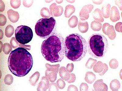 儿童甲醛中毒会出现什么症状呢,妈妈要注意孩子的这些表现