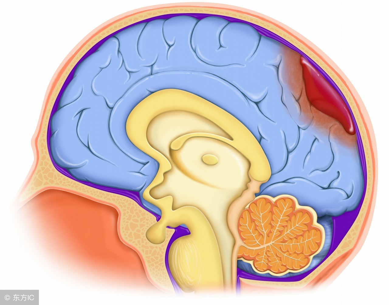 脑震荡后遗症有什么症状能治好吗,脑震荡不及时治疗有哪些后遗症